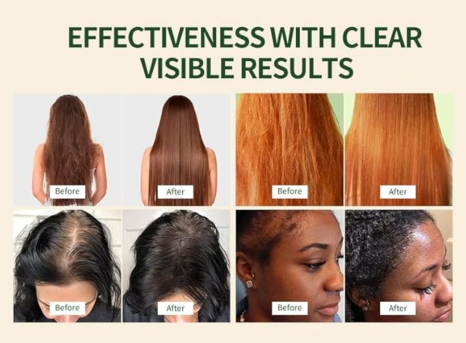 Batana Oil Conditioner for Dry Damaged Hair – Hydrating & Repairing Hair Treatment with Organic Batana Oil, Sulfate-Free & Paraben-Free – Smoothing, Detangling, Color Safe, 5.3 fl oz