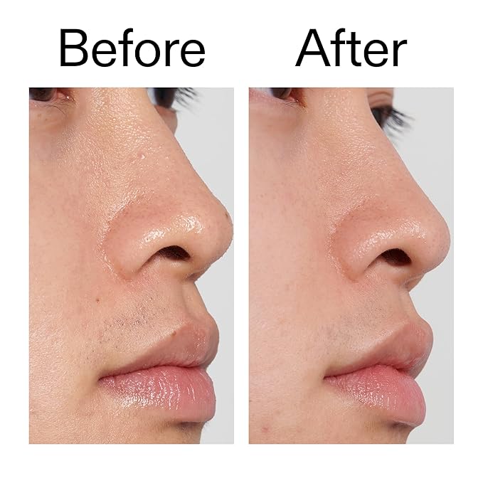 The Inkey List PHA Toner 100ml, Locks in Moisture, Improves Skin Texture, Fragrance Free, Suitable for All Skin Types