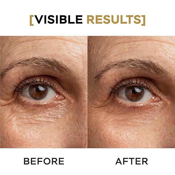 VITASEI Moisturizing Eye Cream w/Aloe Vera, Collagen, Hyaluronic Acid, Cotton Stem Cells for Dark Circles, Puffiness & Bags - Under Eye Hydration Cream for Women & Men (1 Fl Oz)