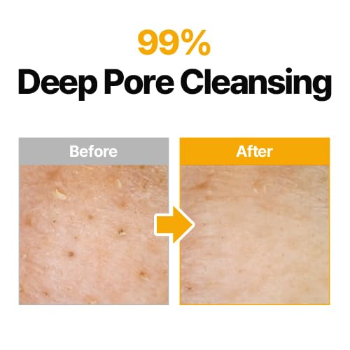 MANYO Herb Green Cleansing Oil, Gentle Makeup Remover with Natural Herbal Extracts, Artemisa, Tea Tree, Deep Cleansing & Hydrating, Suitable for All Skin Types, Korean Skincare 6.7 fl oz (200ml)