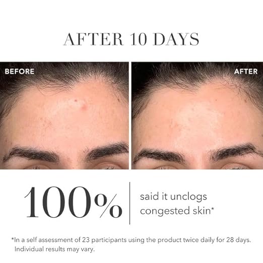 Algenist GENIUS Liquid Skin Resurfacing Face Toner - Gentle 2% BHA Liquid Exfoliant with Salicylic Acid & Collagen - Minimizes Pores, Firms & Smooths Fine Lines - Vegan Anti Aging Skin Care (3.4 oz)