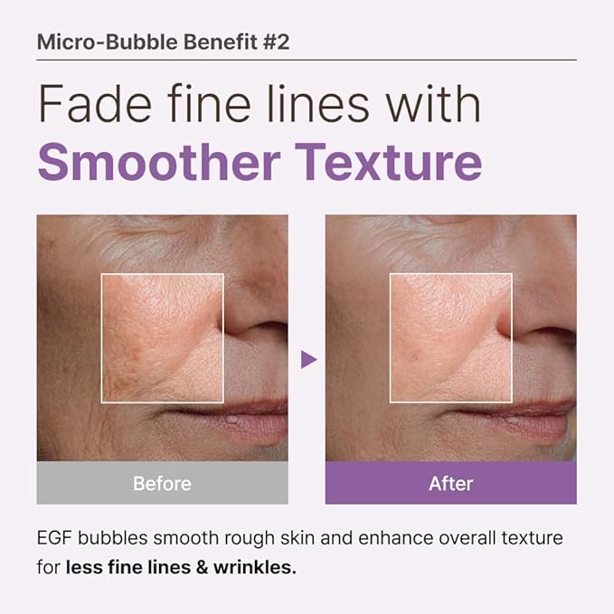 MENOKIN 30 Seconds Quick Bubble Mask [REPAIR] - [EGF Liposome] in Micro-bubbles for Skin Restoration, Hypoallergenic Bubble Capsule for Deep Repair, Korean Skin Care Essential, 52 Uses, 2.36 fl.oz