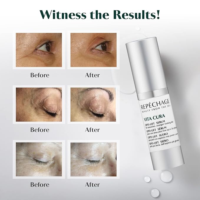 Repechage Vita Cura Opti-Lift Serum – Lightweight, Smoothing Serum for Eyes & Targeted Areas, Helps Lift & Refine Skin Texture – for Puffiness, Fine Lines & Under-Eye Shadows (15 mL / 0.5 fl oz)
