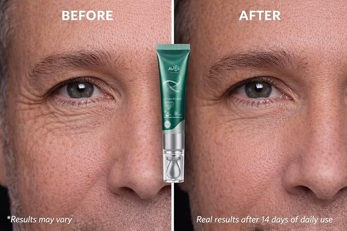 Lifting Power Eye Fluid | Rejuvenating Eye Contour Fluid with 5 Peptides & Vitamins | Niacinamide, Vitamin C, Palmitoyl Tripeptide-1 | 15ml