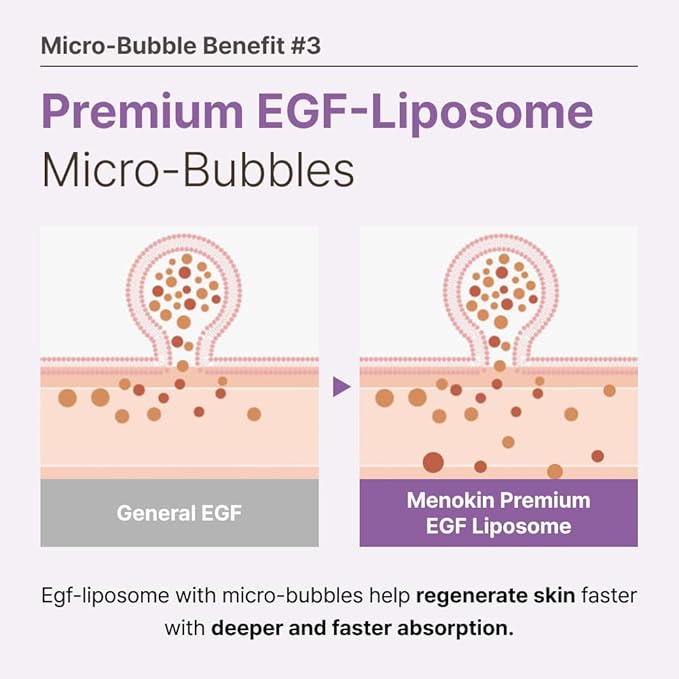MENOKIN 30 Seconds Quick Bubble Mask [REPAIR] - [EGF Liposome] in Micro-bubbles for Skin Restoration, Hypoallergenic Bubble Capsule for Deep Repair, Korean Skin Care Essential, 52 Uses, 2.36 fl.oz
