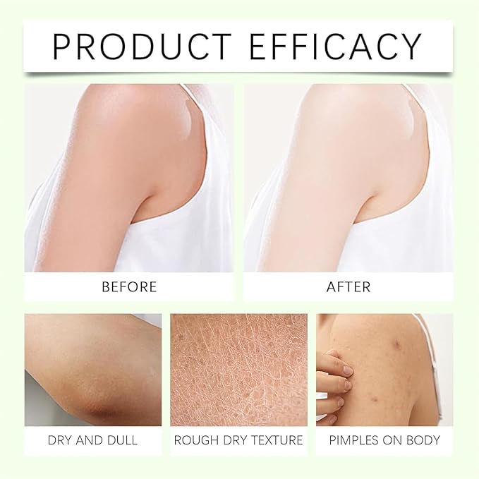 Neuropathy Cream, Magnesium Body Butter,Magnesium Cream for Neuropathy, Deeply Moisturizes Skin, Keep Soft Smooth, Suitable for All Skin Types (114g/1pcs)