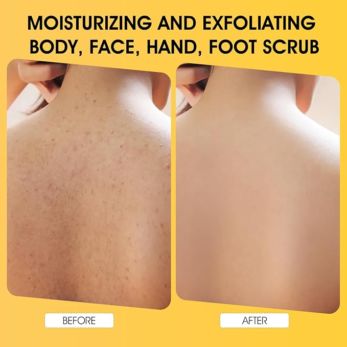 Body Scrub,Turmeric Exfoliating Body Scrub with AHA & BHA, Gentle Body Exfoliator with Vitamin C for Body Hand Foot Bikini Area - 11.3oz