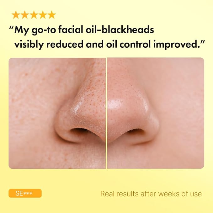 Hanskin Pore Cleansing Oil, Oil Cleanser for Face, Makeup Blackhead Sebum Remover, Korean Deep Pore Cleanser for Sensitive Skin [PHA] (10.14 oz)