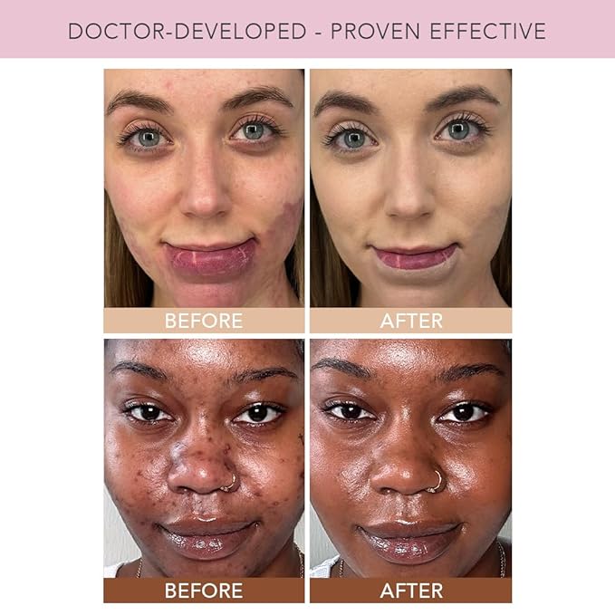 Doll 10 TCE Liquid Filter – CC Cream - Liquid Foundation - Lightweight Tinted Moisturizer & Skin Tint - Blurs Pores & Fine Lines - Vegan - Clean Makeup - [Tan/Deep] - 30 Day Supply