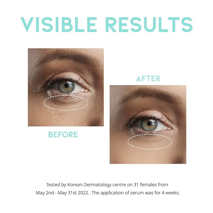 Retinol Eye Cream Serum For Wrinkle Lift, Anti Aging, Under Eye Bag, Puffy Eyes and Dark Circles Treatment, Ceramide, Hyaluronate, Korean Vegan Facial Serum 30g