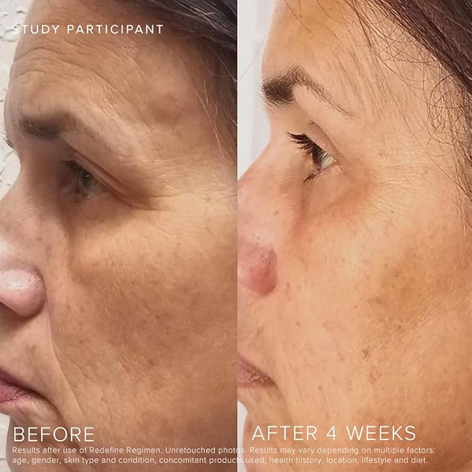 RODAN + FIELDS Redefine Daily Foaming Cleanser | 125 mL | Gently Exfoliating Skin Care | Face Wash & Makeup Remover | Deep Cleansing with Anti Aging Properties
