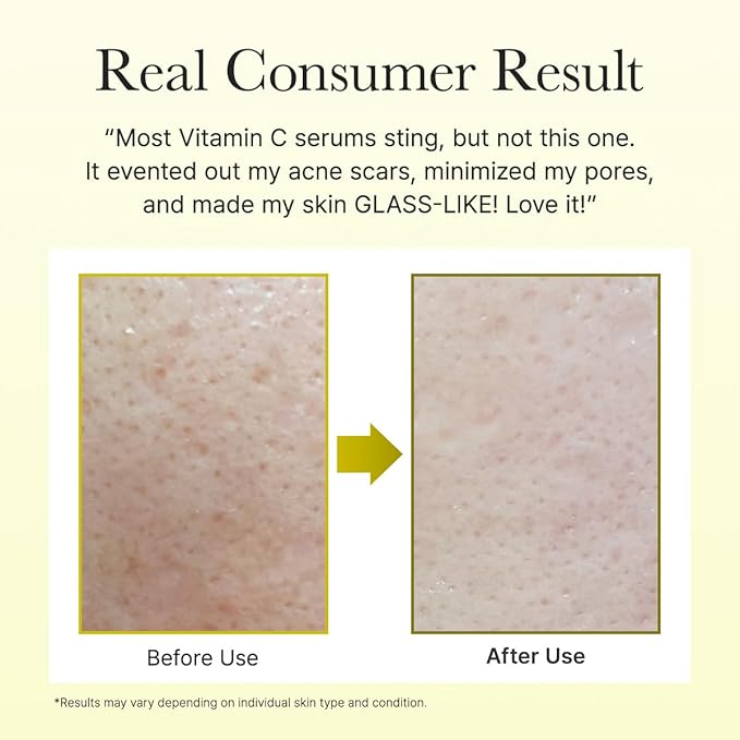 Arencia Vitamin C Booster Shot Serum with Glutathione, Niacinamide and Vitamin E for Glow Skin 1.01 fl oz