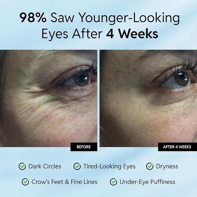 Korean Anti-Aging Eye Cream - Smooths Wrinkles, Firms and Hydrates - With Ceramides and Caffeine - Reduces Fine Lines and Puffiness - Fast-Absorbing, Invisible Under Makeup - 15ml