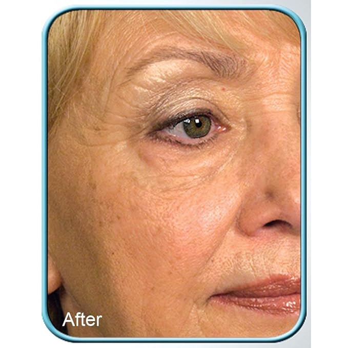 STEM CELL THERAPY CREAM BY BIOLOGIC 1oz JAR