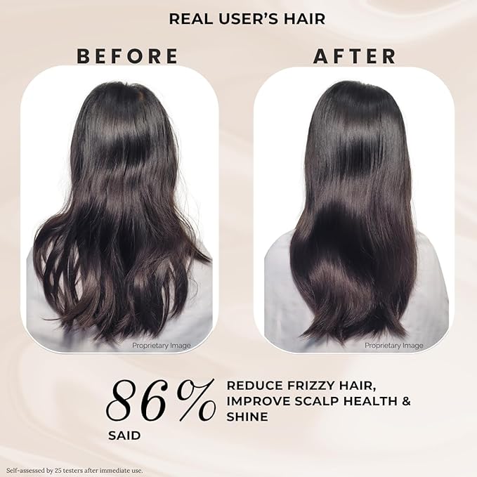 K C Scalp Detox & Hair Repair Mask, Deep Conditioning Treatment with Protein for Dry & Damaged Hair, pH Balanced, All Hair Types (WOMEN)