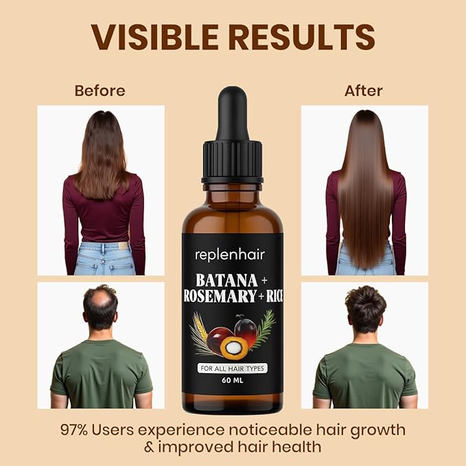 Batana Oil for Hair Growth Oil with Rosemary Castor, 100% Pure, Organic, Cold-Pressed, Unrefined Batana from Honduras by Dr. Sebi - Natural, Vegan, for Strong Roots and Thick Hair, 8oz