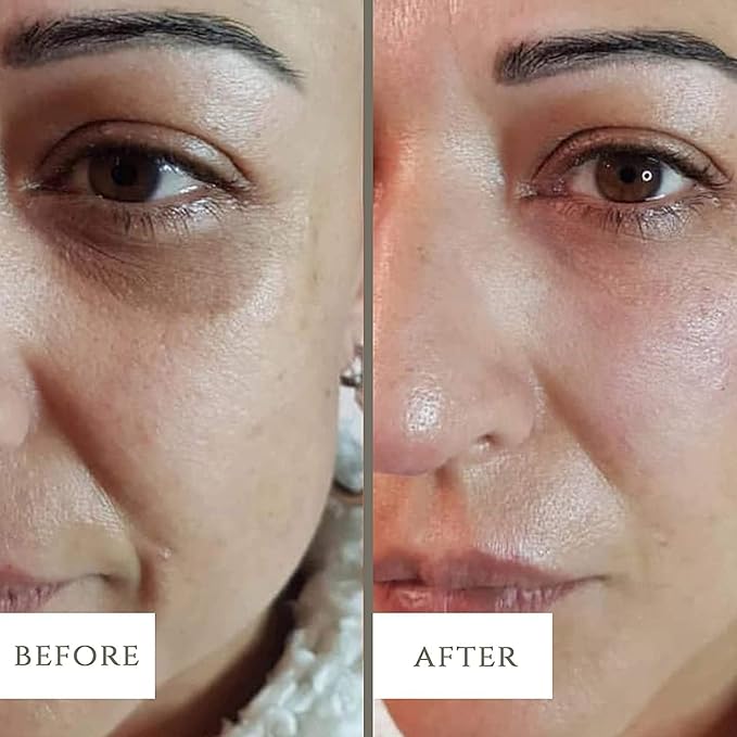 Dark Circle, Eye Bag Anti-Wrinkle Nourishing Eye Cream