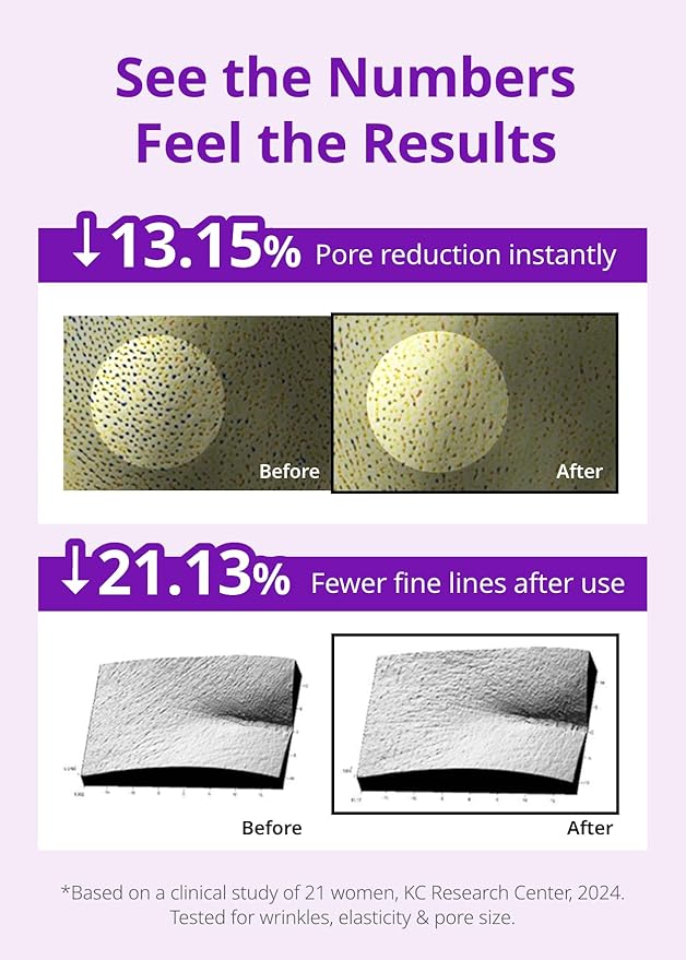SNP 10,000ppm Deep Collagen + PDRN + Retinol Hydrogel Mask | 8 Layer 125Da Collagen Face Mask | Overnight Facial Mask | Patent Skin Hydration | Hydrating Facial Mask | Face Mask Skin Care | 4 Sheets