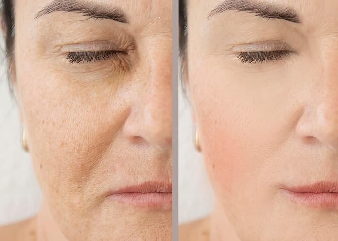 Vitality Precision Skin Phloretin C Serum