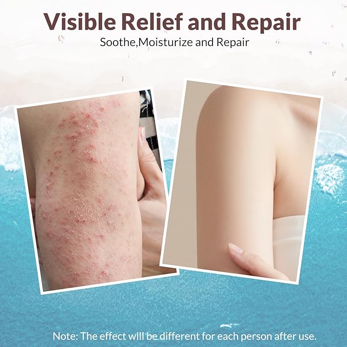Crogooe Natural Soothing Eczema Cream With Sea Moss Aloe Vera Oats for Multiple Skin Types Comfort Moisture Hydrate Eczema Cream for Dry Skin 4FL Oz