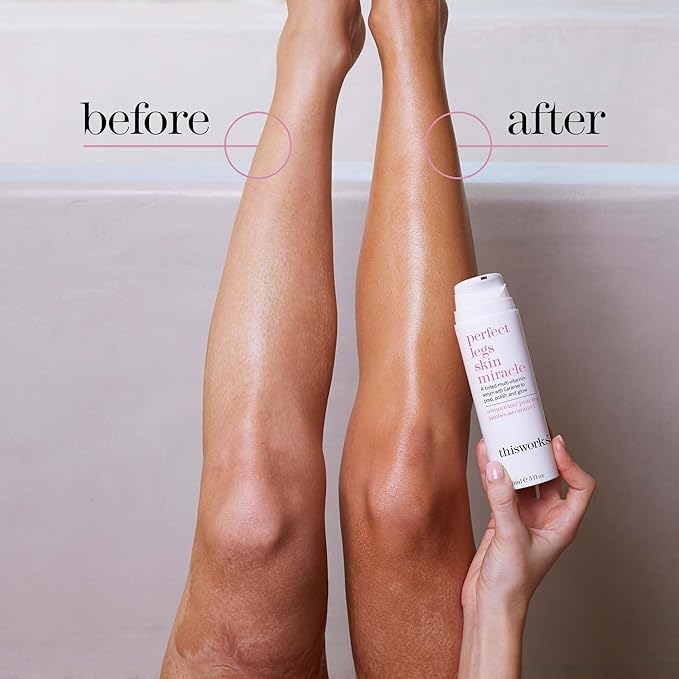 THISWORKS Perfect Legs Skin Miracle: Tinted Serum with Vitamin C & E for Radiant, Sun-Kissed Glow, Evens Skin Tone & Reduces Imperfections, 5 fl oz