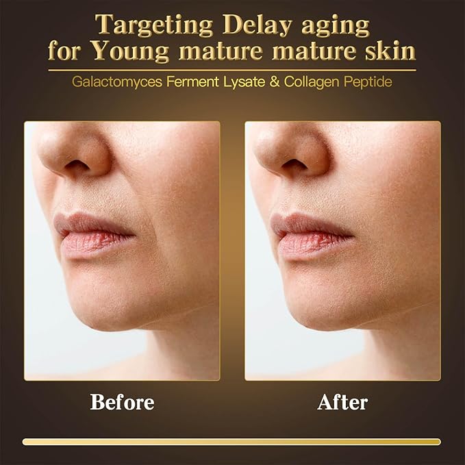 24K Gold & Caviar Collagen Face Mask, 5 Pack – Luxurious Hydrating Facial Treatment, Firming Appearance – Supports a Radiant, Rejuvenated Look Overnight