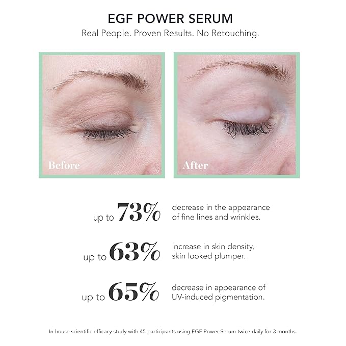 BIOEFFECT EGF Power Serum with Epidermal Growth Factor from Barley, Hyaluronic Acid, KGF and a form of Glucosamine (NAG) to Visibly Reduce Wrinkles & Discolorations, Hydrating Anti-Aging Treatment