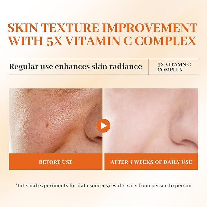 Vitamin C Skincare Set, 2x Toners & 1x Serum, 5X Vitamin C Complex with Hyaluronic Acid & Niacinamide, Hydrating Toner to Refresh Skin & Face Serum to Improve Texture, For All Skin Types