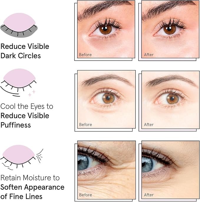 grace & stella Award Winning Under Eye Mask Reduce Dark Circles, Puffy Eyes, Undereye Bags, Wrinkles, Gel Under Eye Patches, Christmas Gifts Under 10 Dollars, Nurse Gifts, Vegan (6 Pairs, Blue)