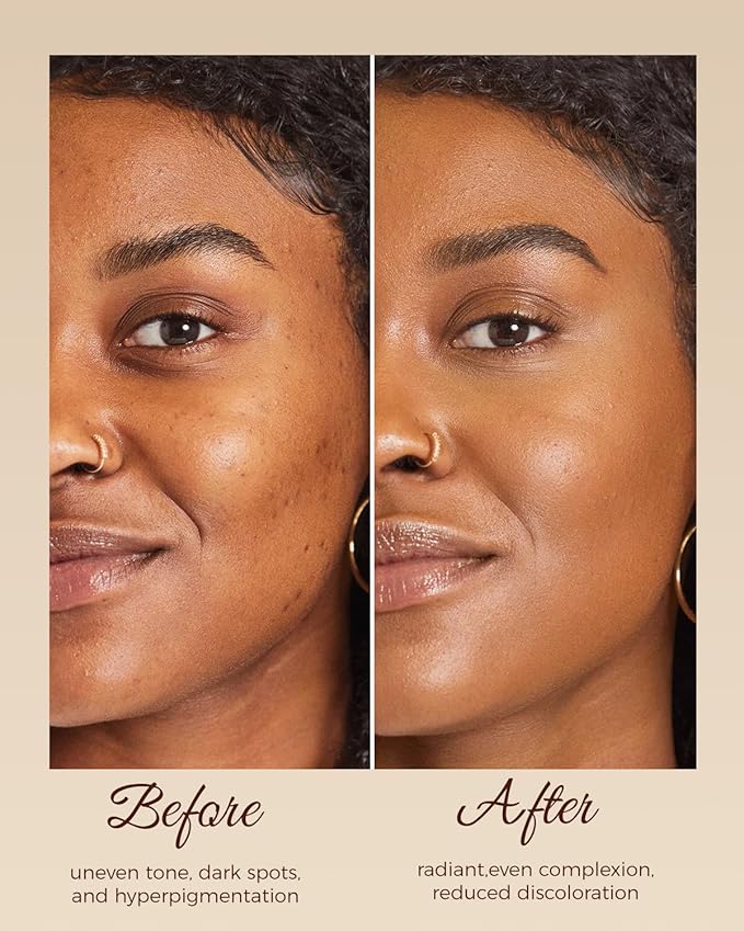 Kojic Acid Soap, Turmeric Soap for Dark Spots with Vitamin C & Shea Butter, Paraben & Sulfate-Free - 3 Bars with African Net Sponge