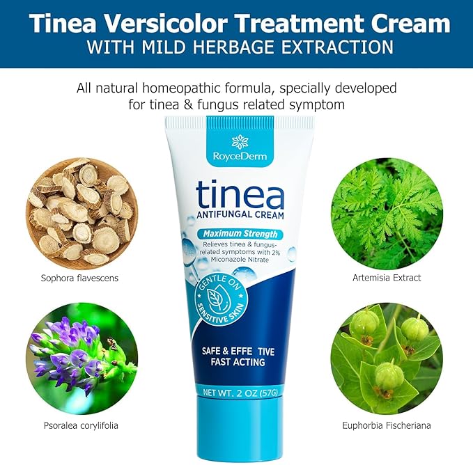 Roycederm Tinea Versicolor Treatment, Athletes Foot Treatment, Ringworm Treatment for Humans, for Tinea Versicolor & Pedis,Fast Healing Anti Fungal Skin Cream - Multi-Functional