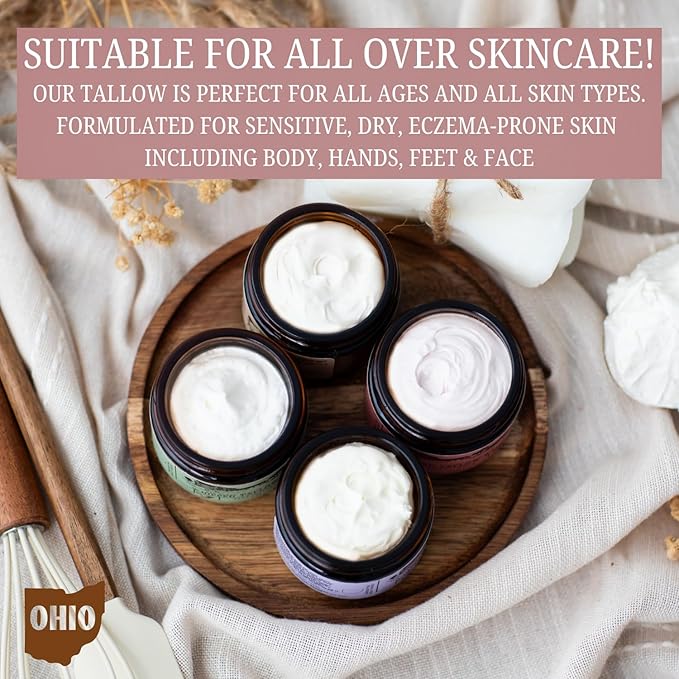 Rose-infused 100% Grass-Fed Whipped Tallow Balm-Organic Raw Manuka Honey & Organic Jojoba Oil, Rosehip Oil, Face and Body Moisturizer for Dry, Sensitive Skin, Eczema (Honey Rose)