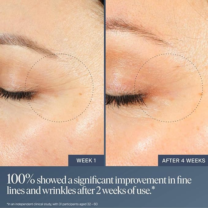 Summer Fridays Jet Lag Overnight Eye Serum - Nourishing Undereye Treatment for Dark Circles - Helps to Hydrate, Smooth, Firm & Depuff - Enriched with Glycerin to Lock in Moisture (0.5 Fl Oz)