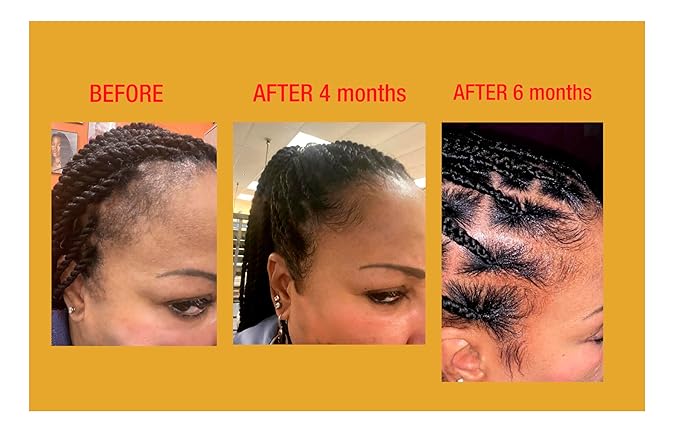 GOOD2GRO Edge Control Gel - 4oz | Instant Hold, Moisture Infusion & Shine Boost | Repair & Restore Thicker Edges Growth | Vegan & Cruelty-Free