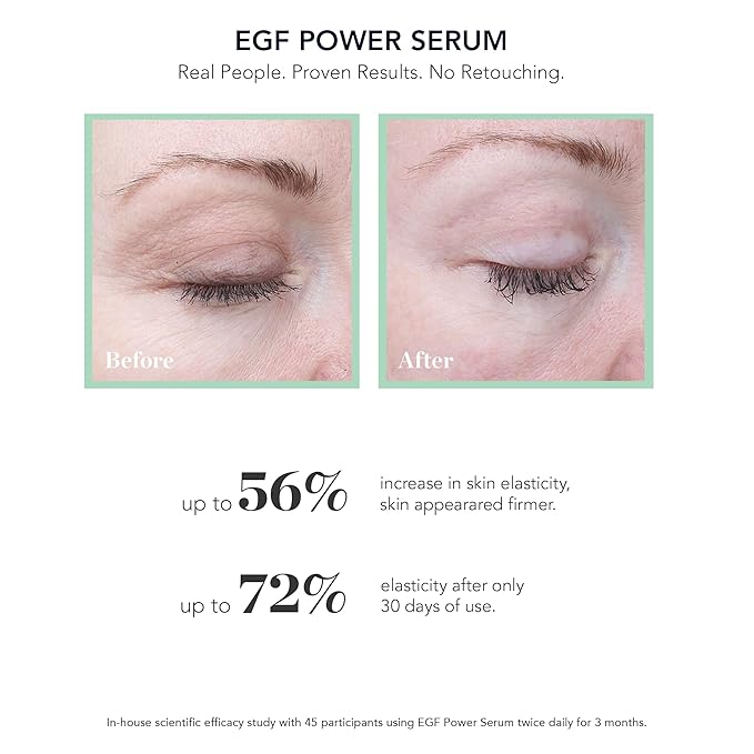 BIOEFFECT EGF Power Serum with Epidermal Growth Factor from Barley, Hyaluronic Acid, KGF and a form of Glucosamine (NAG) to Visibly Reduce Wrinkles & Discolorations, Hydrating Anti-Aging Treatment