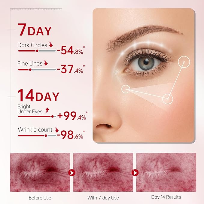 Peunitory Eye Balm Stick,Under Eye Cream Anti-Wrinkle Firming Treatment | Dark Circle Brightener | Hydrating (0.32oz)