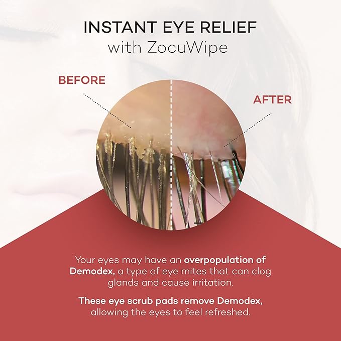 Zocular - Zocuwipe Eyelid Wipes with Natural Okra Complex - Eyelid Cleanser and Moisturizer Pads - Eyelid Cleansing Wipes - Blepharitis Treatment - 40ct