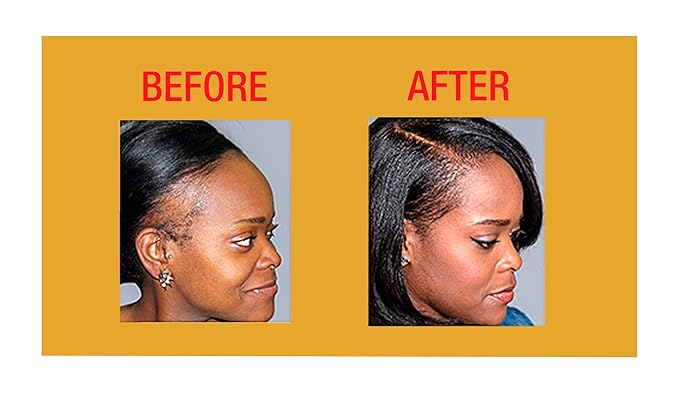 GOOD2GRO Edge Control Gel - 4oz | Instant Hold, Moisture Infusion & Shine Boost | Repair & Restore Thicker Edges Growth | Vegan & Cruelty-Free