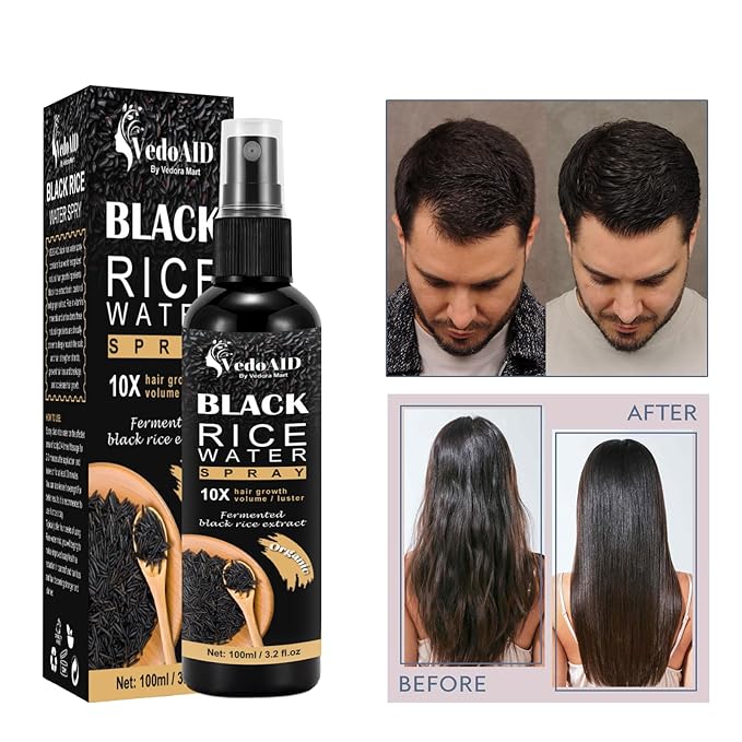 Black Rice Water Spray for Hair Growth – Organic Hair Serum with Castor Oil & Ginger Root – Strengthens, Thickens & Repairs Hair – Hair Loss Treatment for Women & Men – 100ml/3.2 fl.oz (1pc)