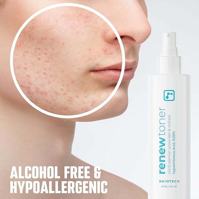BRIOTECH Renew Toner, Hypochlorous Acid Spray, Minimize Appearance of Blemishes, Soothing Facial Mist for Sensitive Skin, Calm Redness & Bumps, Vegan, 4 fl oz (2 Pack)