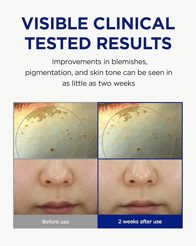 CKD Vita C Teca Blemish Shot Face Gel Mask with Vitamin C & Centella Asiatica (5ea) - Korean Hydrogel Mask for Glass Glow Skin, Dark Spot and Blemish Korean Skincare Routine