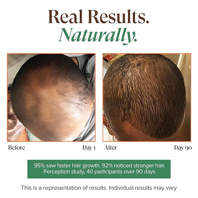 Kreyol Essence - Haitian Black Castor Oil for Skin and Hair, Glass Bottle - Cold Pressed | Hexane Free | Fuller-Looking Hair, Natural Humectant, Lavender Hibiscus. 2 Fl Oz
