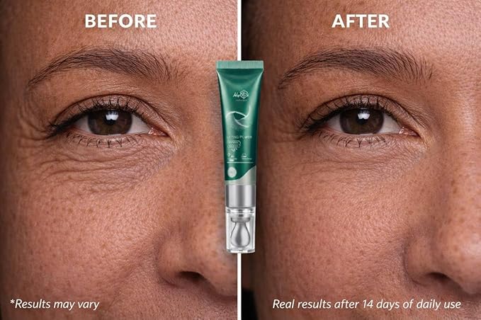 Lifting Power Eye Fluid | Rejuvenating Eye Contour Fluid with 5 Peptides & Vitamins | Niacinamide, Vitamin C, Palmitoyl Tripeptide-1 | 15ml