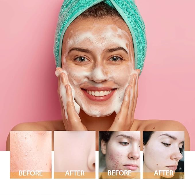 Turmeric Facial Cleanser, Deep Cleansing Facial Wash With Brush, Turmeric Foaming Cleanser for All Skin (2Pcs)