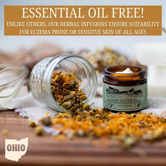 100% Grass-Fed Whipped Tallow Balm & Organic Jojoba Oil infused:Organic Calendule & Chamomile: face & body moisturizer-dry, baby, sensitive skin/eczema, psoriasis (HERB-INFUSED/UNSCENTED)
