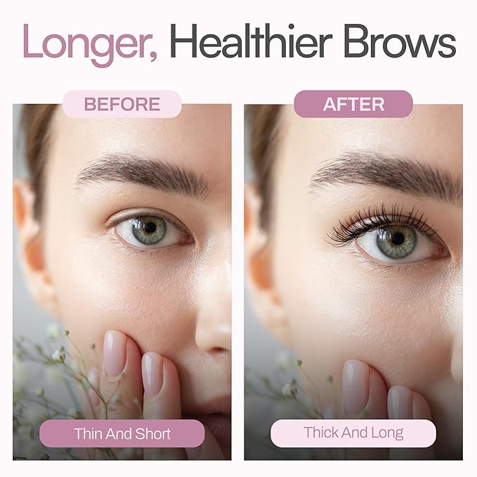 Foltene Eyelash & Eyebrow Treatment - Lash and Brow Serum with Applicator - Stimulate Growth for Thicker Longer Fuller Eyelashes & Eyebrows - Strengthening & Protective Effect - Nutrition Conditioner