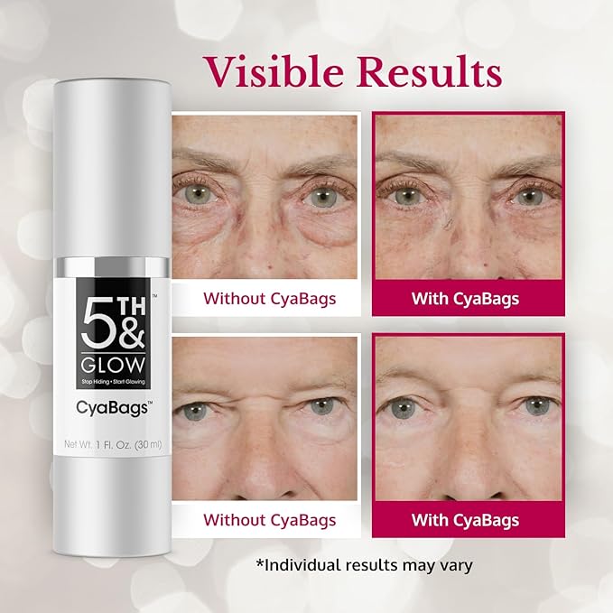 5th & Glow Cyabags - Instant Under Eye Bag Remover Serum For Dark Circles & Puffy Eyes Reduction - Hyaluronic Acid & Vitamin C Cream for Fine Lines, Wrinkles & Crowsfeet, 1 oz