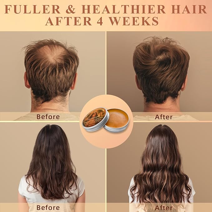 100% Raw Batana Oil for Hair Growth from Honduras, Aceite De Batana Natural Hair Growth Oil for Fuller, Thicker & Healthier Hair 3.72 Fl Oz. Gift for Women And Men