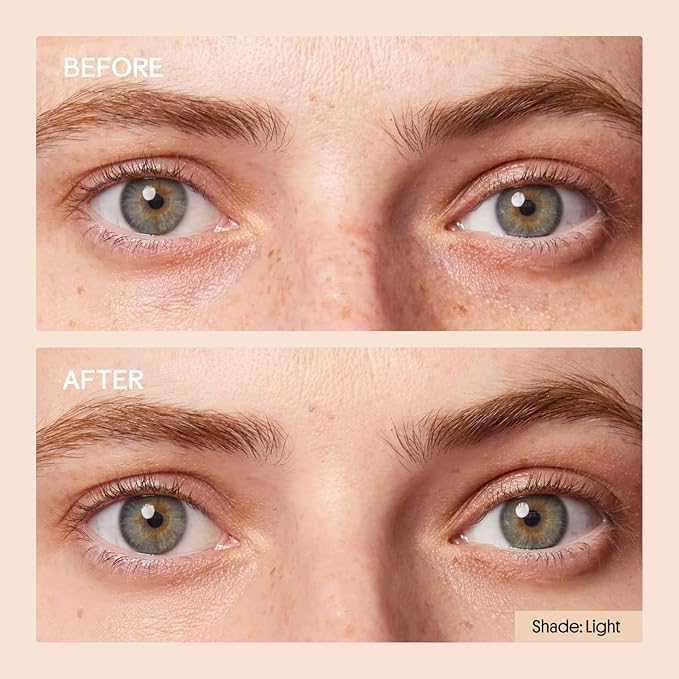 Winky Lux Peeper Perfect Under Eye Concealer, Makeup & Eye Brightener, Full Coverage Concealer for Dark Circles, Color Corrector & Eye Primer With Collagen, Hyaluronic Acid & Vitamin E (Golden Medium)