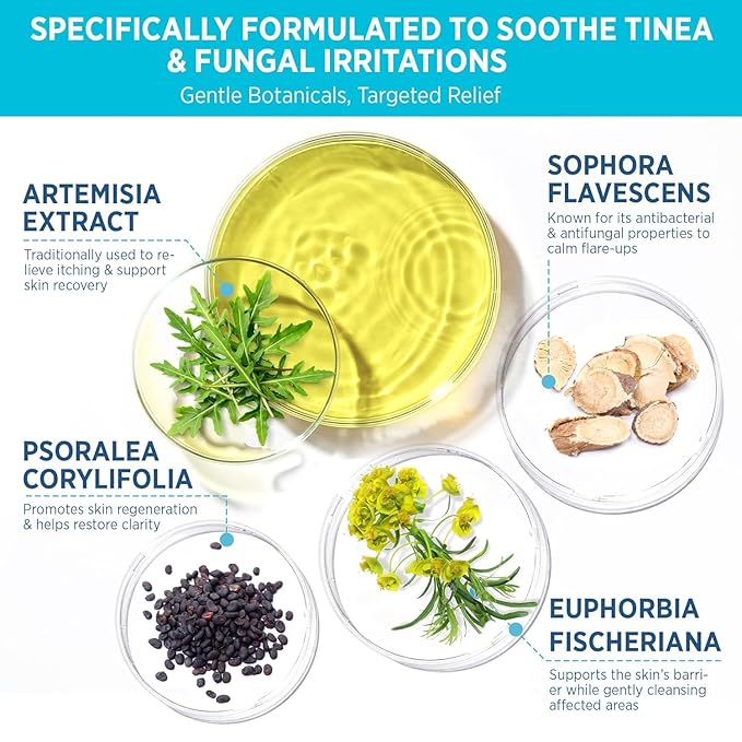Tinea Versicolor Relief Cream & Soap Kit - Helps with Tinea Versicolor, Fungal Skin Conditions – Soothes, Cleanses, and Restores Skin Health